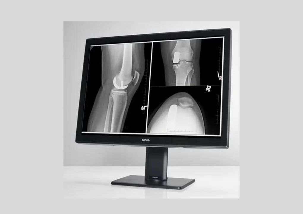 Elevate Radiology Practice With Barco's Premium Display Solutions